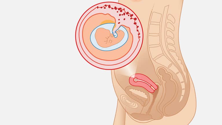 7 Weeks Pregnant Ultrasound