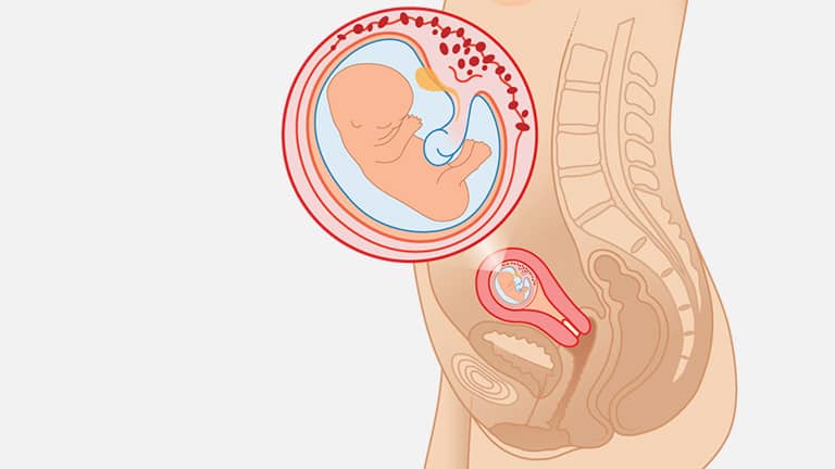10 Weeks Pregnant Ultrasound Parenthoodbliss
