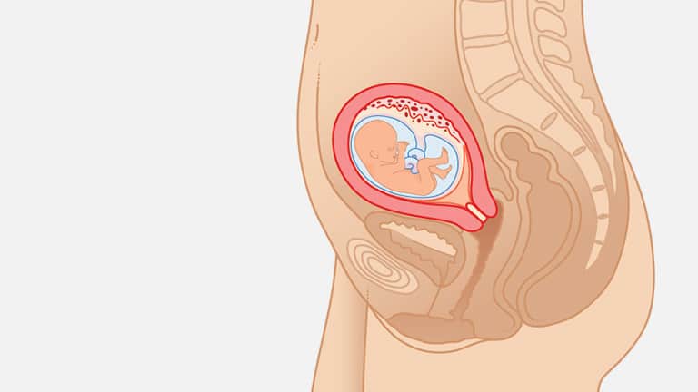 14 Weeks Pregnant Ultrasound Parenthoodbliss