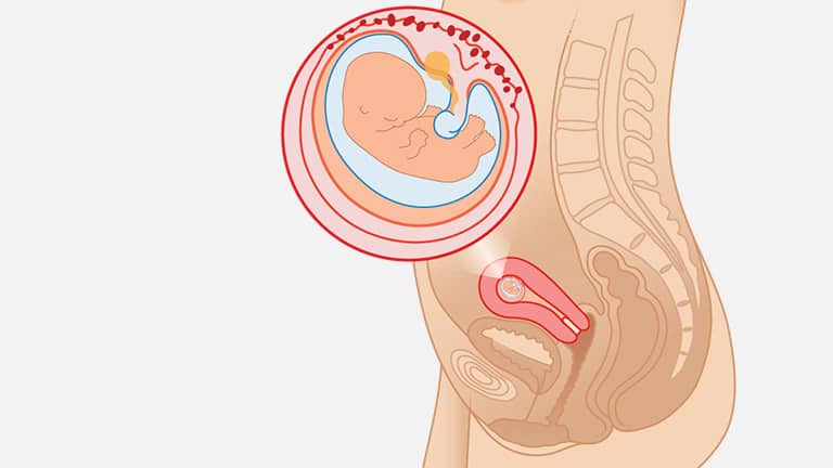 9 Weeks Pregnant Ultrasound