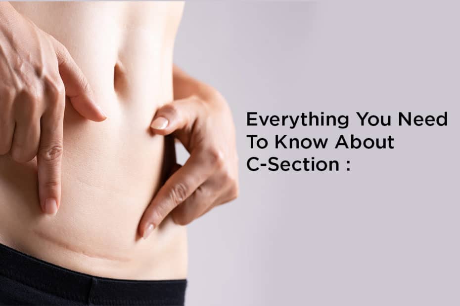 C-Section Everything you need to know