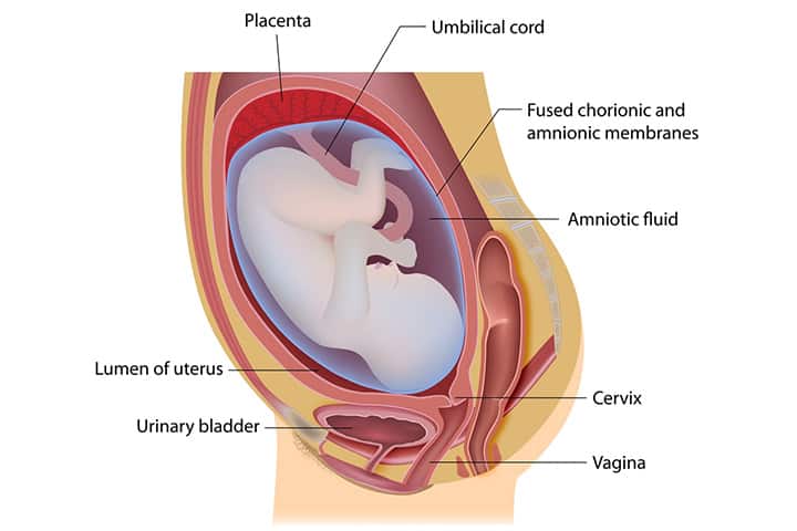 Subchorionic Hematoma in Pregnancy Explained