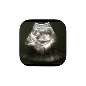 17 Best Free Pregnancy Apps Of 2025- Your All-In-One Guide! 3 Full Term – Contraction Timer