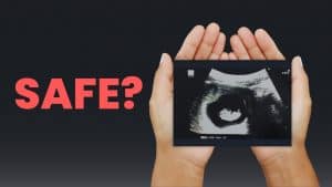are ultrasounds safe