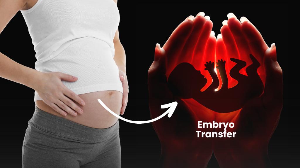 What Is Embryo Transfer and How Does It Work in IVF?