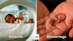 stillbirth vs miscarriage