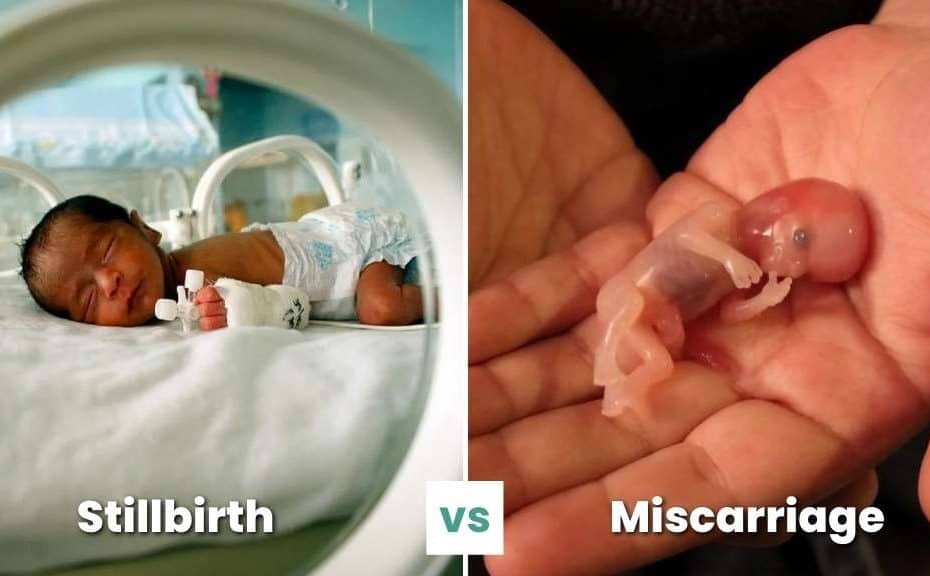 stillbirth vs miscarriage