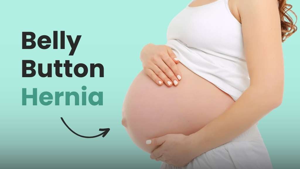 belly-button-hernia-causes-risk-factors-and-treatment