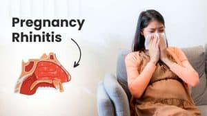 Pregnancy Rhinitis