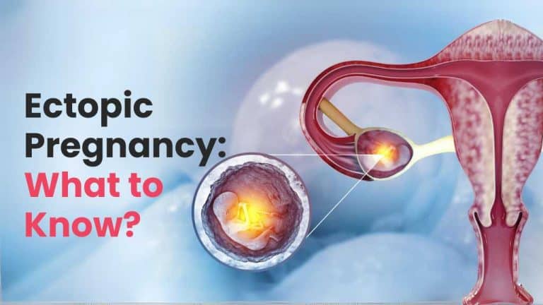 Ectopic Pregnancy Causes Symptoms And Treatment